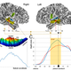 Illustration for article titled The Human Brain Is Lopsided Compared To Other Primates